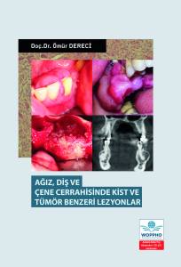 Ağız Diş ve Çene Cerrahisinde Kist ve Tümör Benzeri Lezyonlar